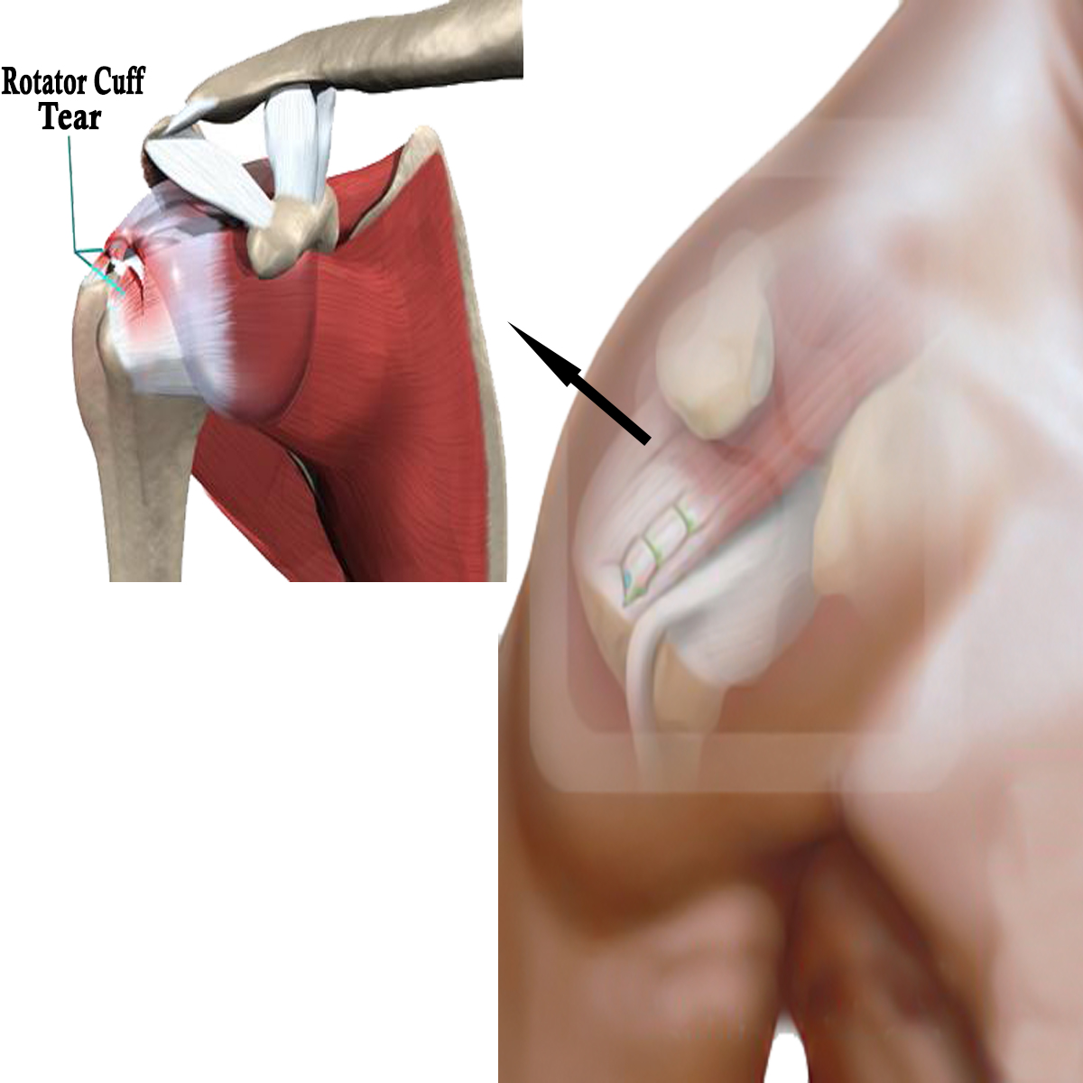 Symptom Image