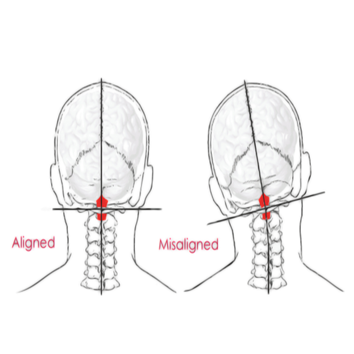 Symptom Image