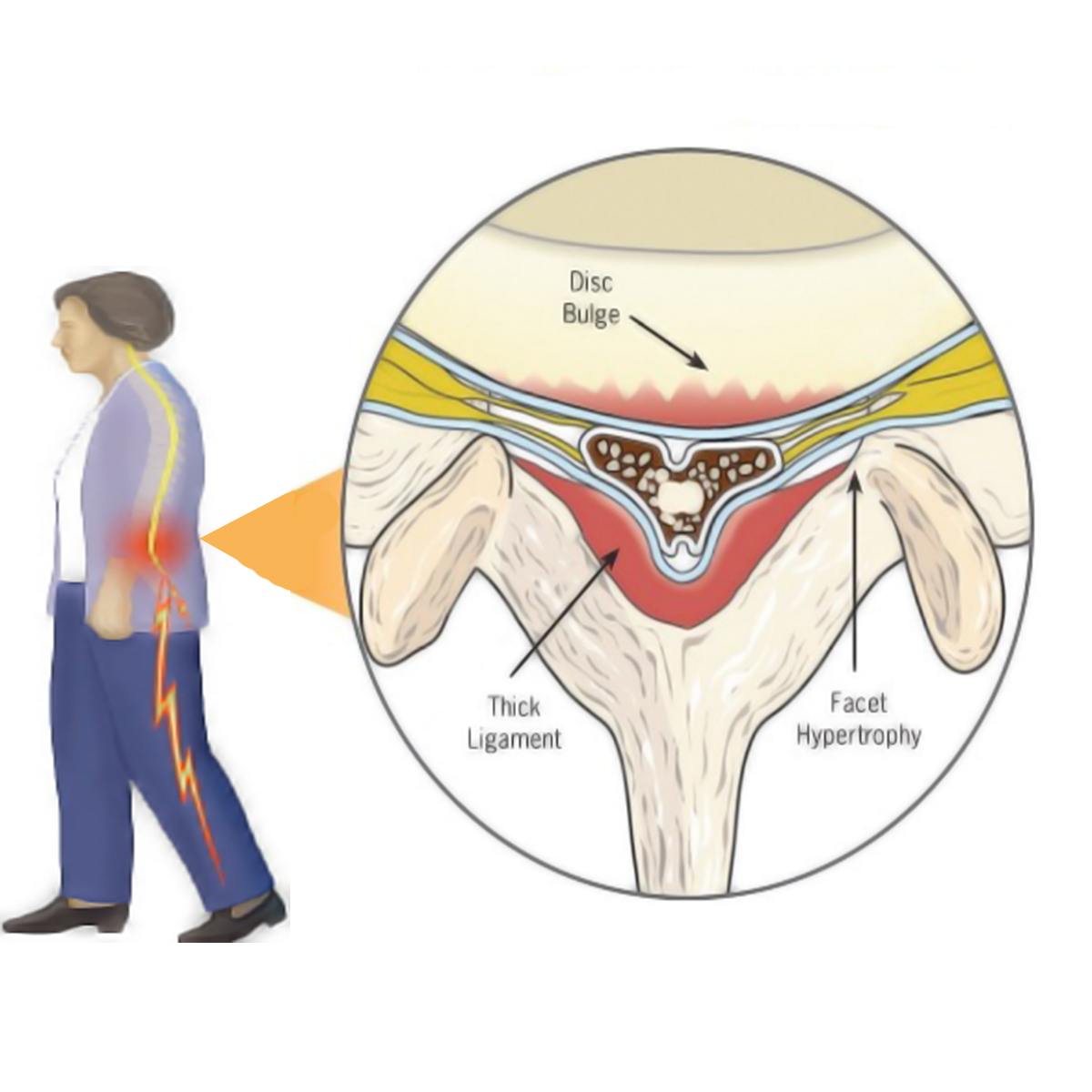 Symptom Image