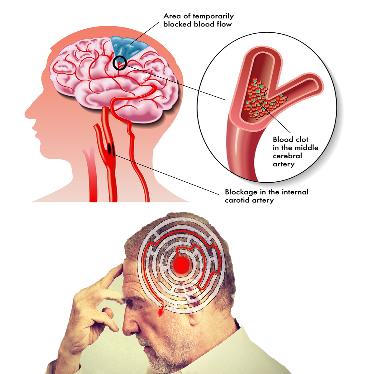Symptom Image